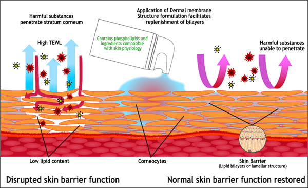 barrier-story-600w IAC - International Association for Applied Corneotherapy barrier-story-600w